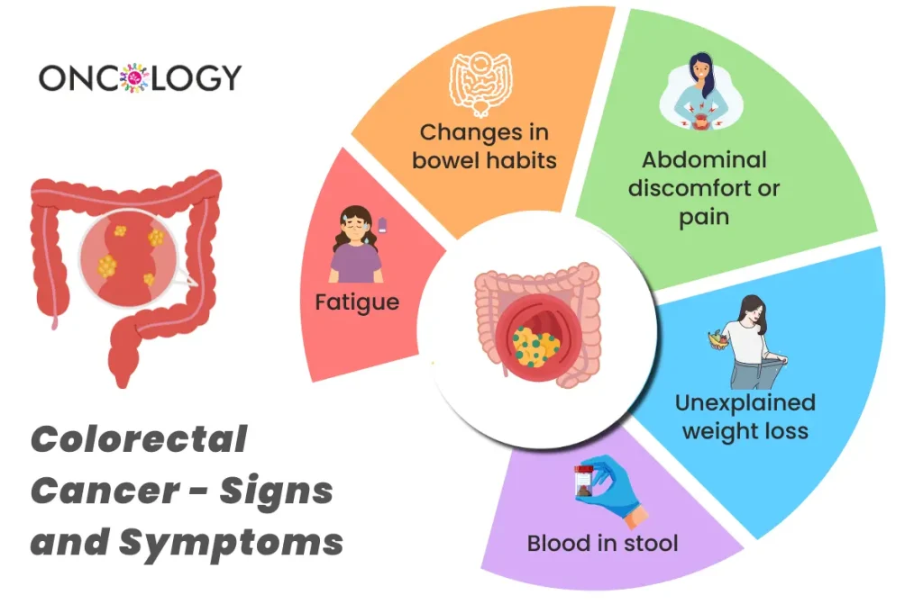 Colorectal Cancer Treatment in Chennai