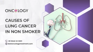 Causes Of Lung Cancer In Non Smoker