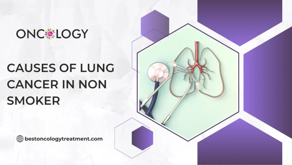 Causes Of Lung Cancer In Non Smoker