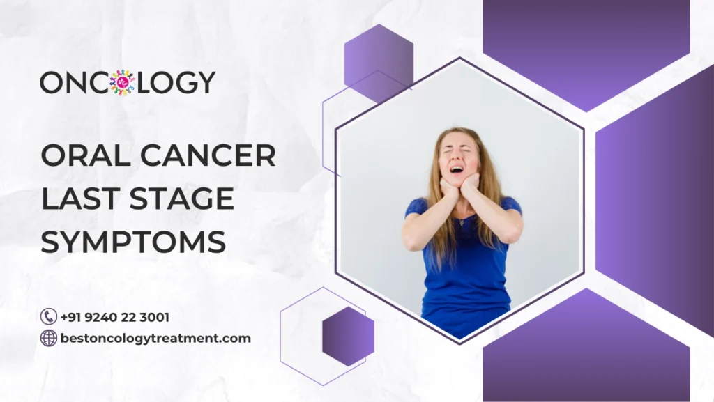 Oral Cancer Last Stage Symptoms